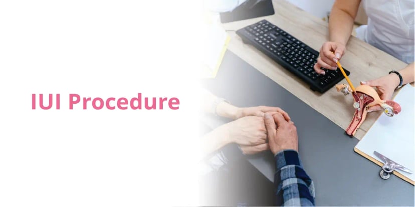 IUI Procedure: Steps, Timeline, Success Rate, Risks & Cost