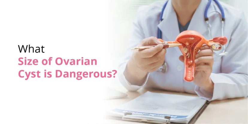 What Size of Ovarian Cyst Is Dangerous? Size Chart, Symptoms & Treatment