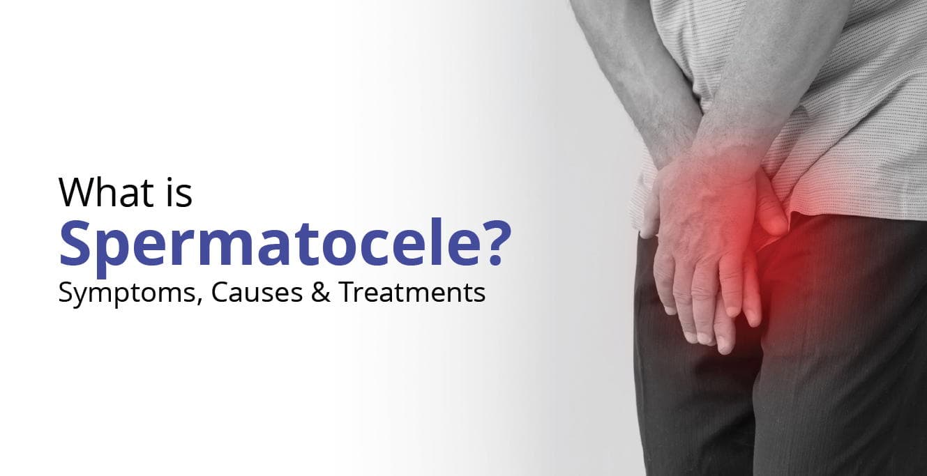 Spermatocele: Symptoms, Causes, and Treatments
