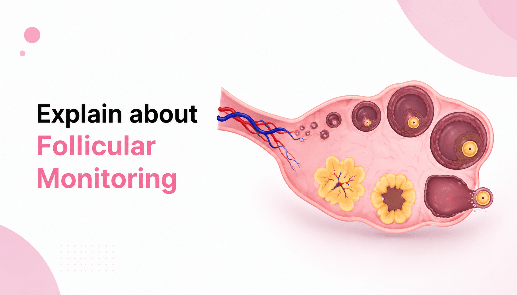 Follicular Monitoring: Purpose, Procedure & Benefits
