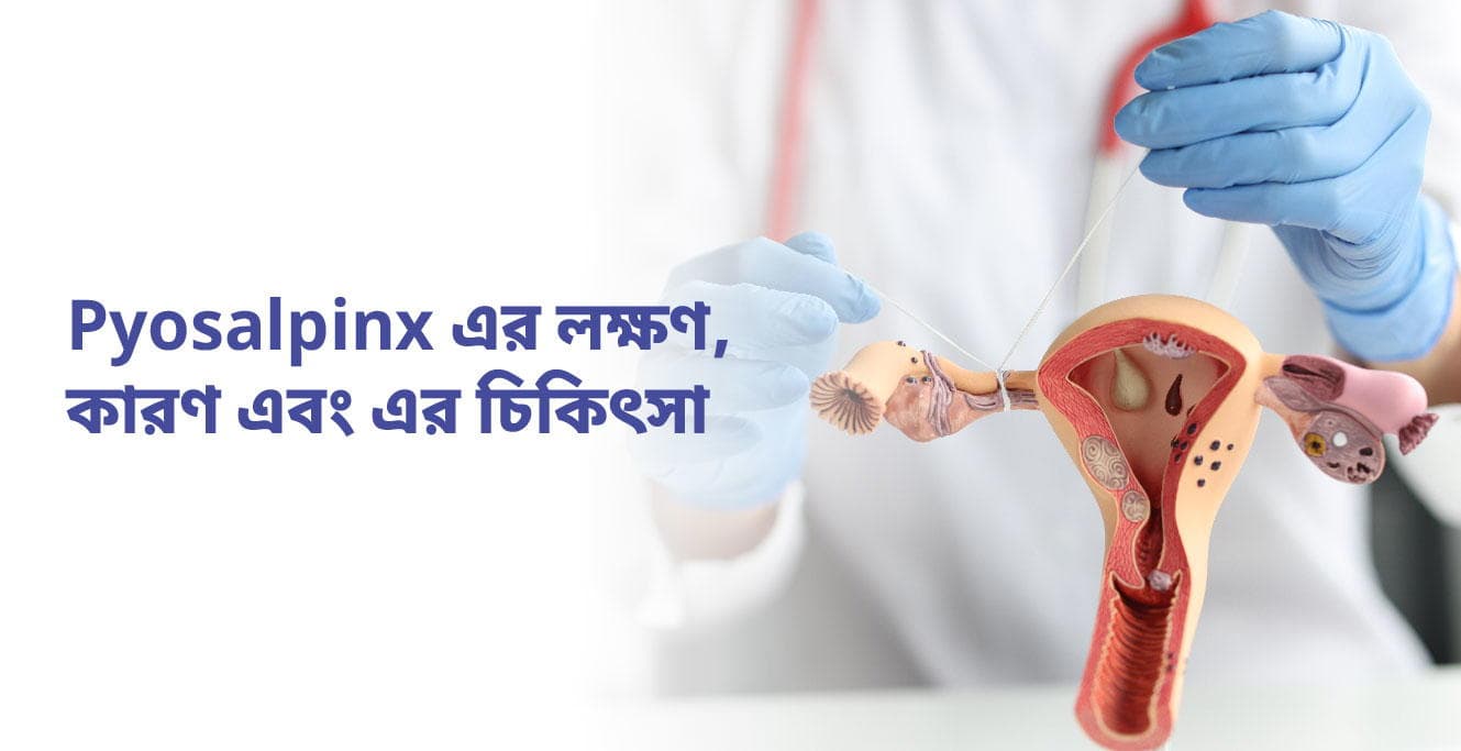 সন্তানলাভের পথে বড় বাধা পায়োসালপিঙ্কস্