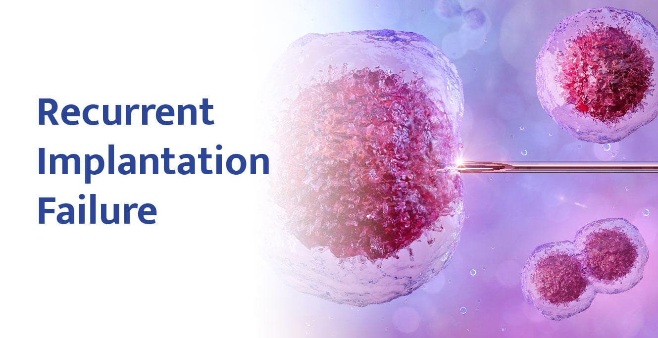 ആവർത്തിച്ചുള്ള ഇംപ്ലാന്റേഷൻ പരാജയം – എന്തുചെയ്യണം?