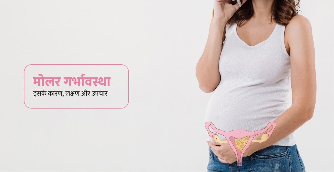 Molar Pregnancy in Hindi – मोलर प्रेगनेंसी क्या है? कारण, लक्षण और उपचार