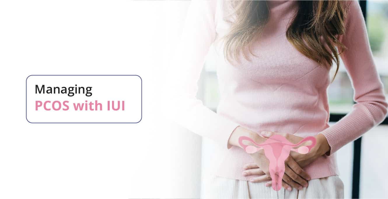 IUI এর সাথে PCOS ফার্টিলিটি চ্যালেঞ্জ ম্যানেজ করা