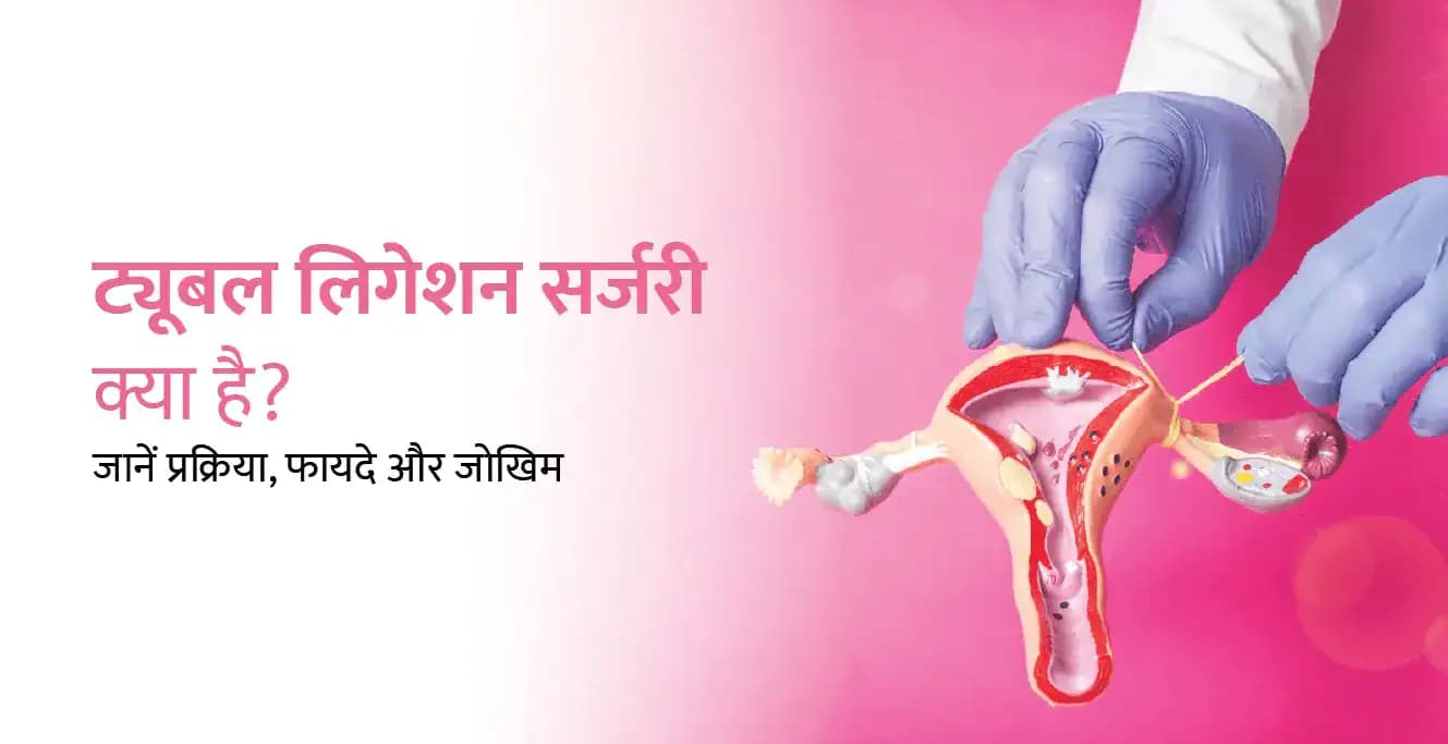 ट्यूबल लिगेशन (Tubal Ligation) क्या है? प्रक्रिया, फायदे, जोखिम और रिकवरी