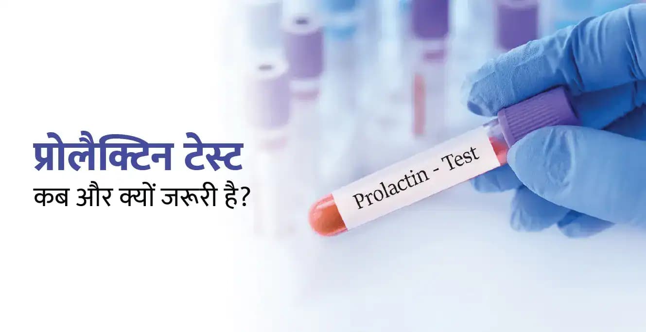 Prolactin Test in Hindi: प्रोलैक्टिन टेस्ट क्या है और यह क्यों किया जाता है?