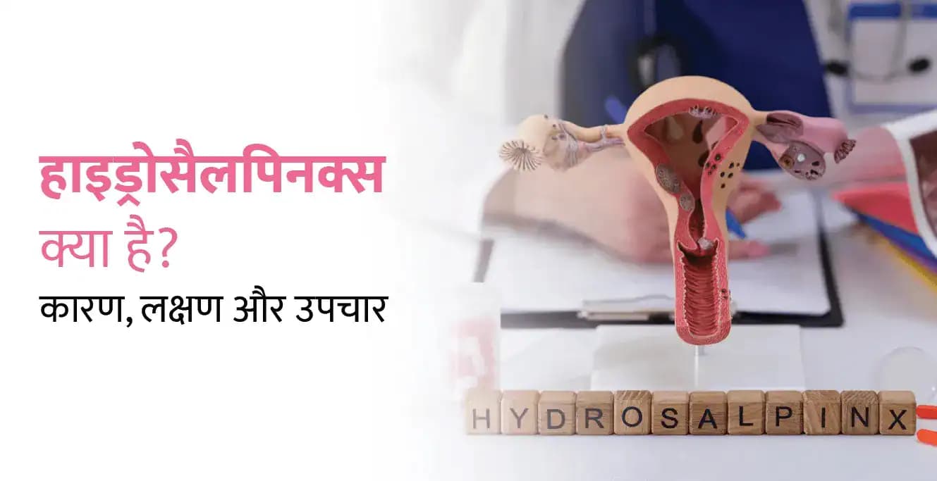 हाइड्रोसैलपिनक्स क्या है? कारण, लक्षण और उपचार (Hydrosalpinx Meaning in Hindi)