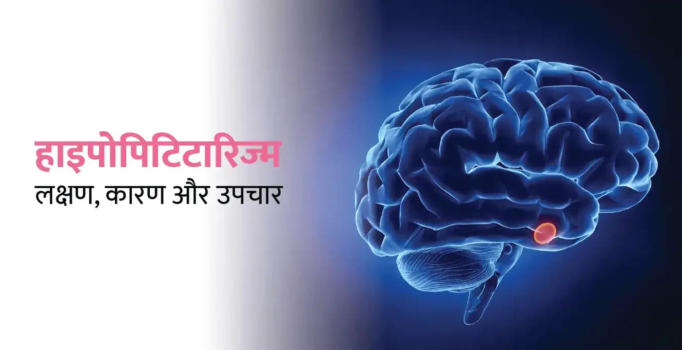 हाइपोपिटिटारिज्म के लक्षण, कारण और उपचार