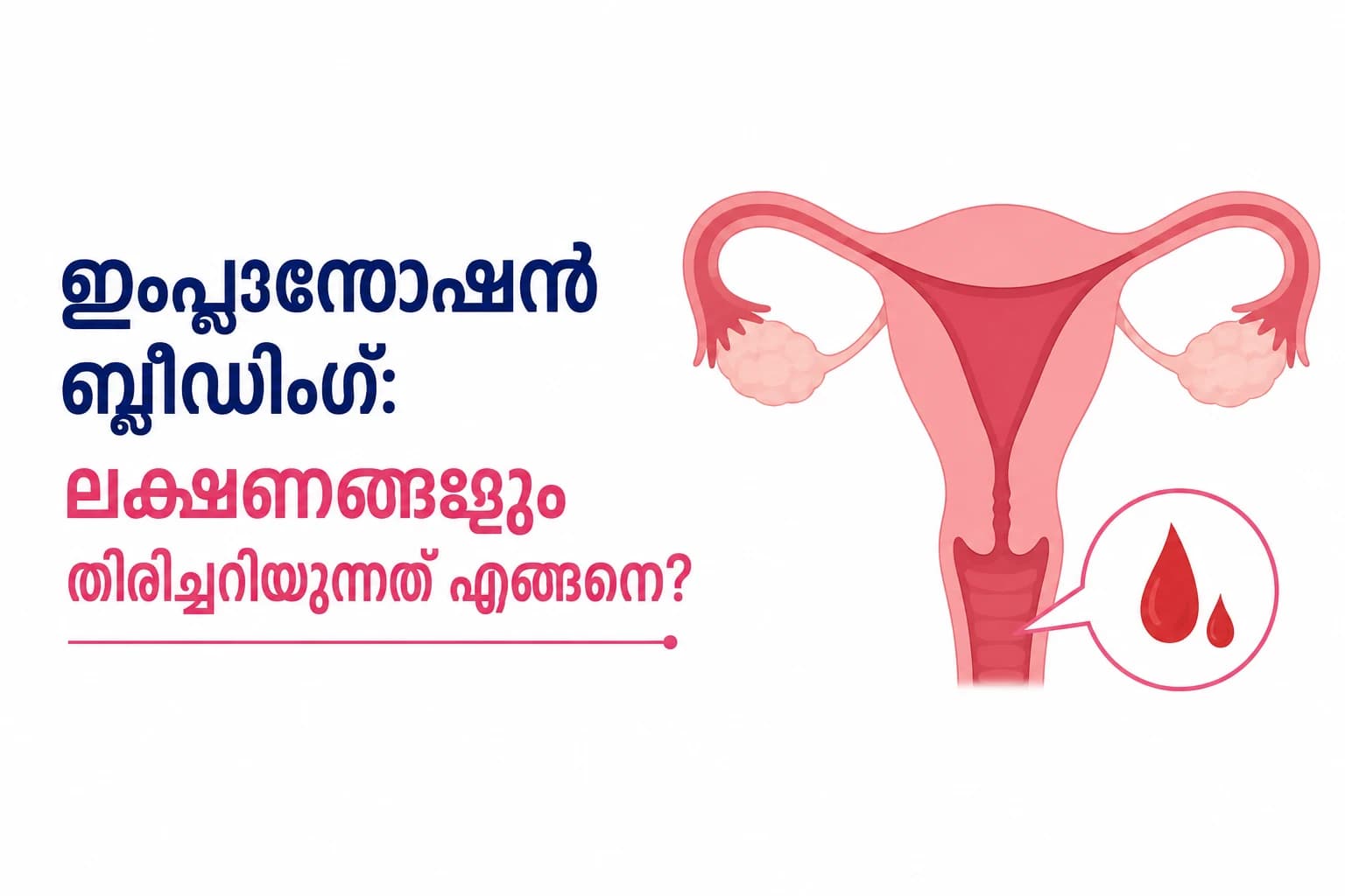 ഗർഭധാരണത്തിനു ശേഷമുള്ള ഇംപ്ലാന്റേഷൻ അടയാളങ്ങളും ലക്ഷണങ്ങളും: അവ എങ്ങനെ തിരിച്ചറിയാം