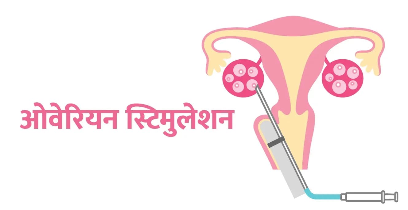 ओवेरियन स्टिमुलेशन प्रक्रिया: प्रक्रिया, लाभ और जोखिम