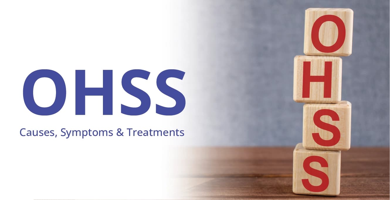 OHSS: Causes, Symptom & Treatment
