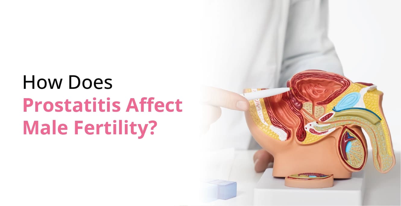 How Does Prostatitis Affect Male Fertility?