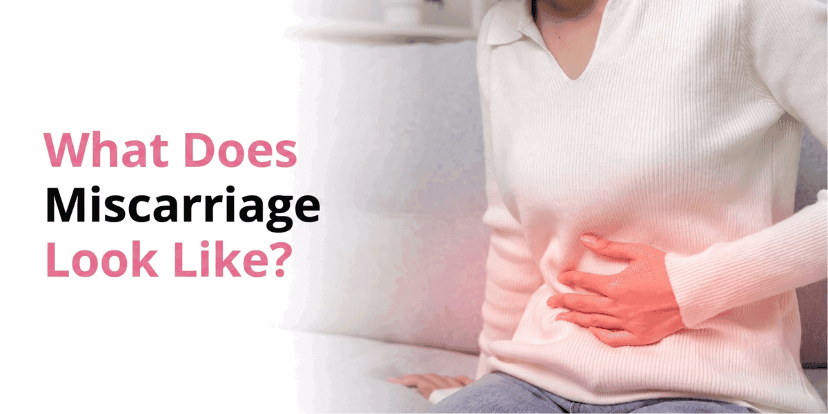 What Does A Miscarriage Look Like?