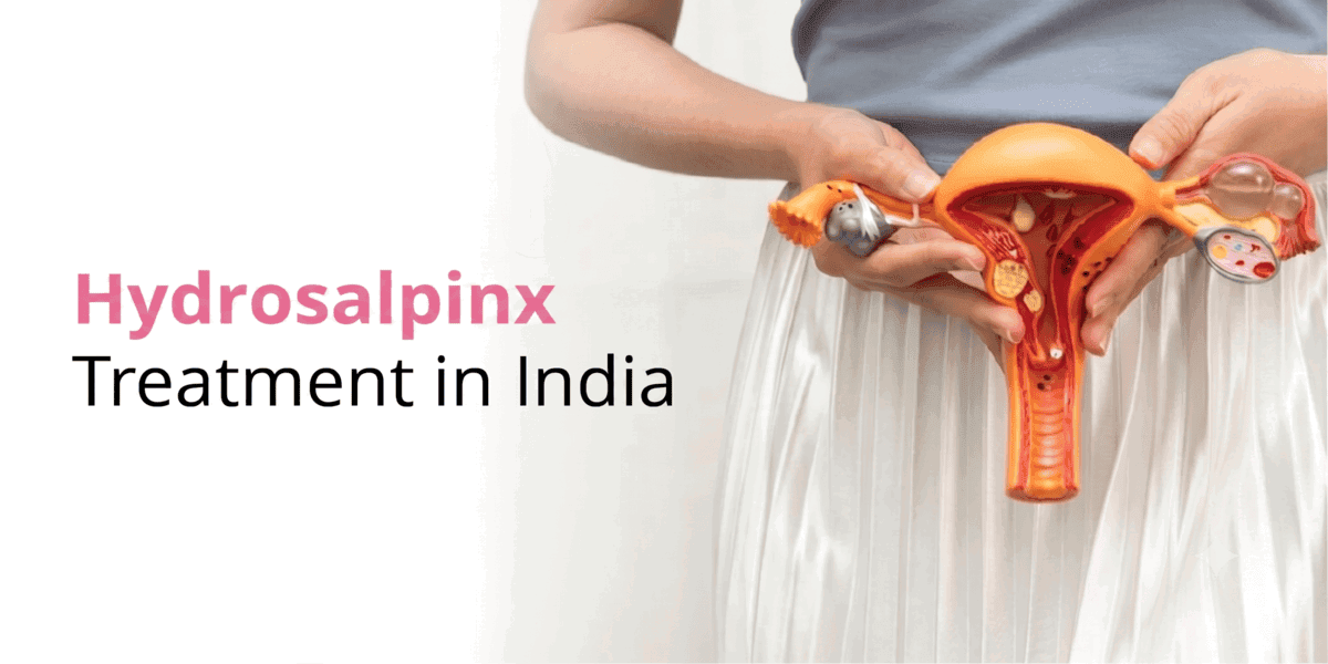 Hydrosalpinx Treatment in India