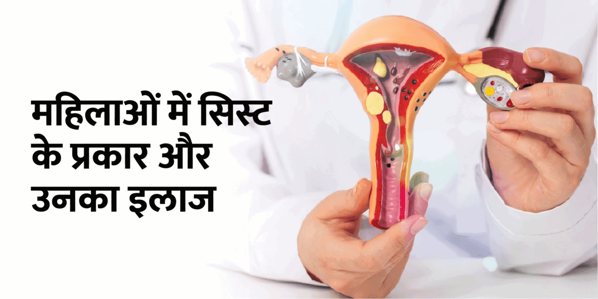 महिलाओं में सिस्ट के प्रकार और उनका इलाज: कारण, लक्षण और कब चिंता करें