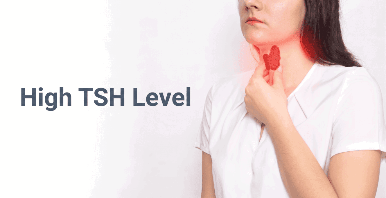 What Is Considered a Dangerously High TSH Level?