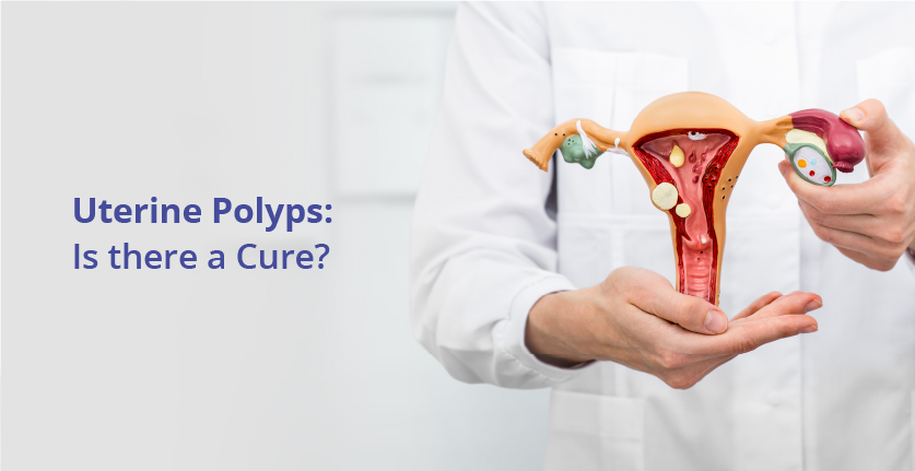 Uterine Polyps : Is there a Cure?