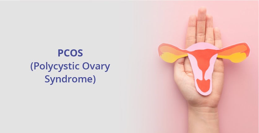 What is PCOS (Polycystic Ovary Syndrome)?