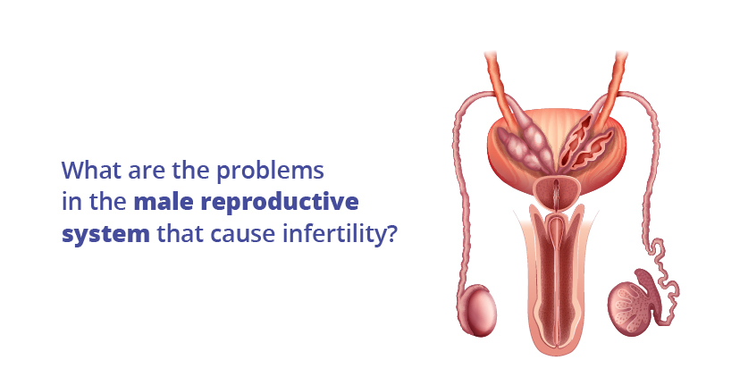 Problems related to male reproductive system