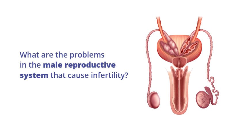 ಪುರುಷ ಸಂತಾನೋತ್ಪತ್ತಿ ವ್ಯವಸ್ಥೆಗೆ ಸಂಬಂಧಿಸಿದ ಸಮಸ್ಯೆಗಳು