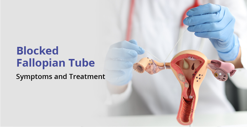 Blocked Fallopian Tube – Symptoms and Treatment