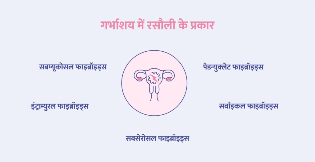 types of uterine fibroids are in the form flow chart in hindi language
