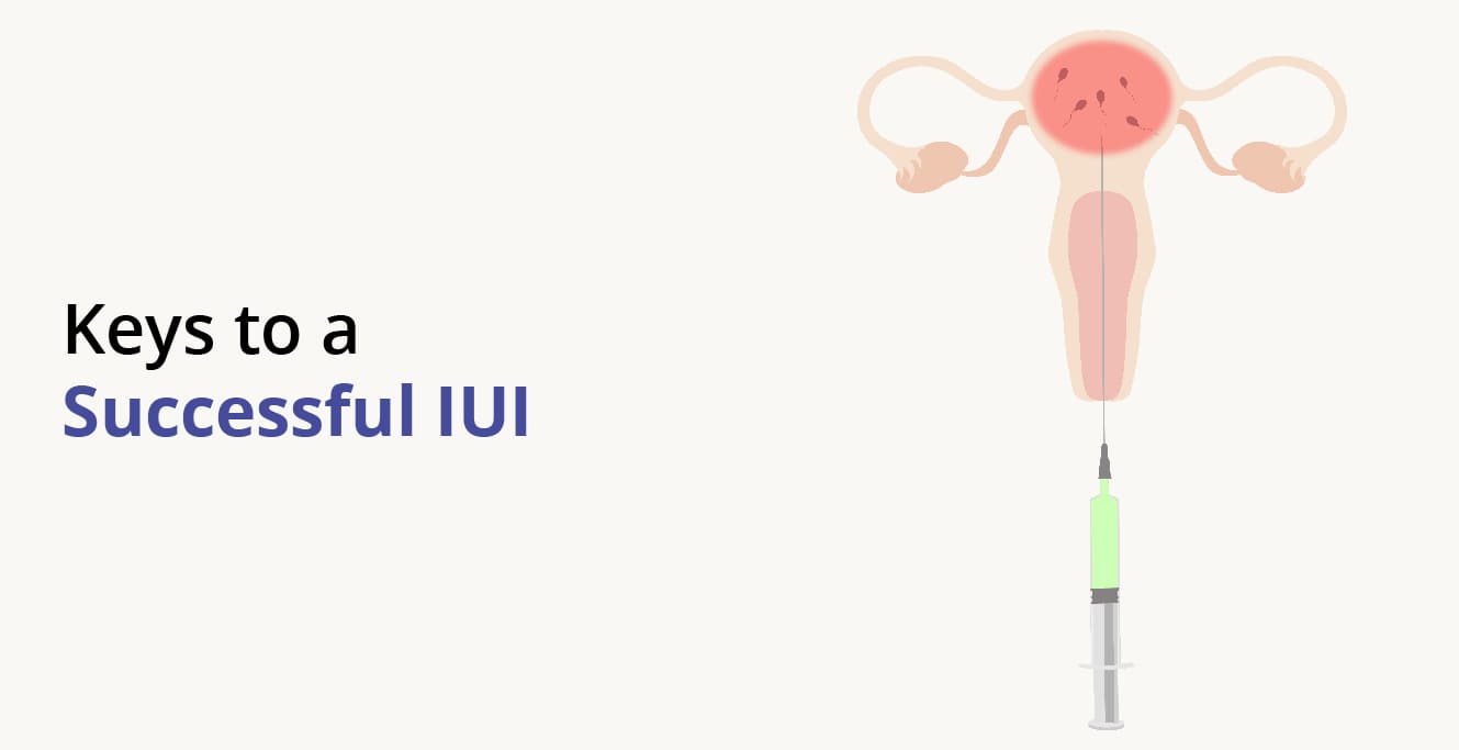 IUI Success Rate: What Are The Chances Of Conception through IUI Treatment?