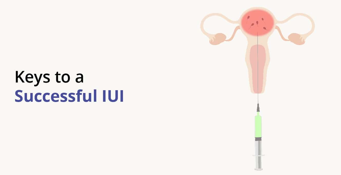 IUI ڪاميابي جي شرح: IUI علاج ذريعي تصور جا امڪان ڇا آهن؟