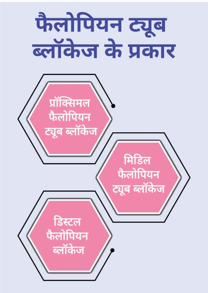 ಟೈಪ್ಸ್-ಆಫ್-ಬ್ಲಾಕ್ಡ್-ಫಾಲೋಪಿಯನ್-ಟ್ಯೂಬ್-ಇನ್-ಹಿಂದಿ