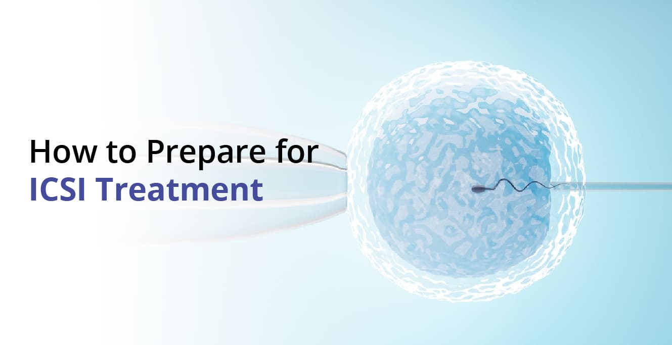 How to Prepare for ICSI Treatment