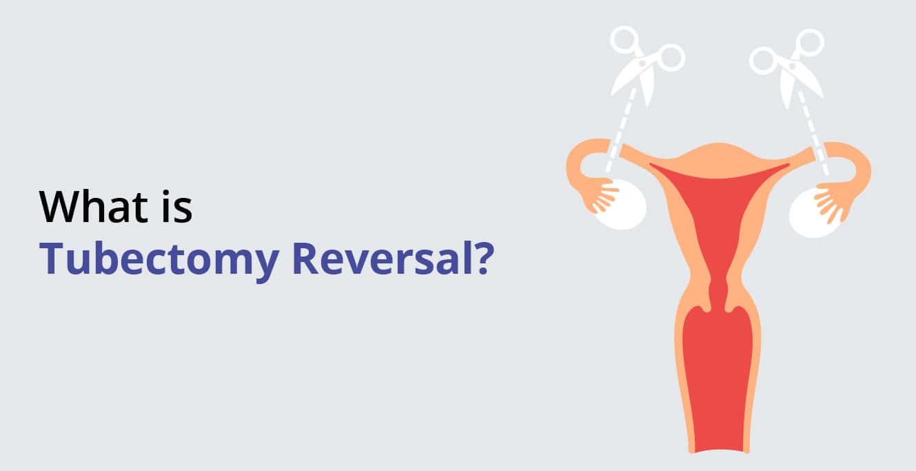 What is Tubectomy Reversal?