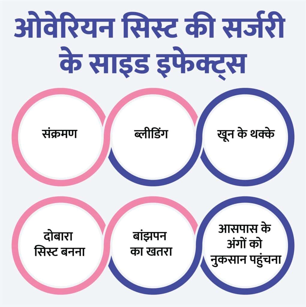 ovarian-cyst-in-hindi-birla-fertility-ivf