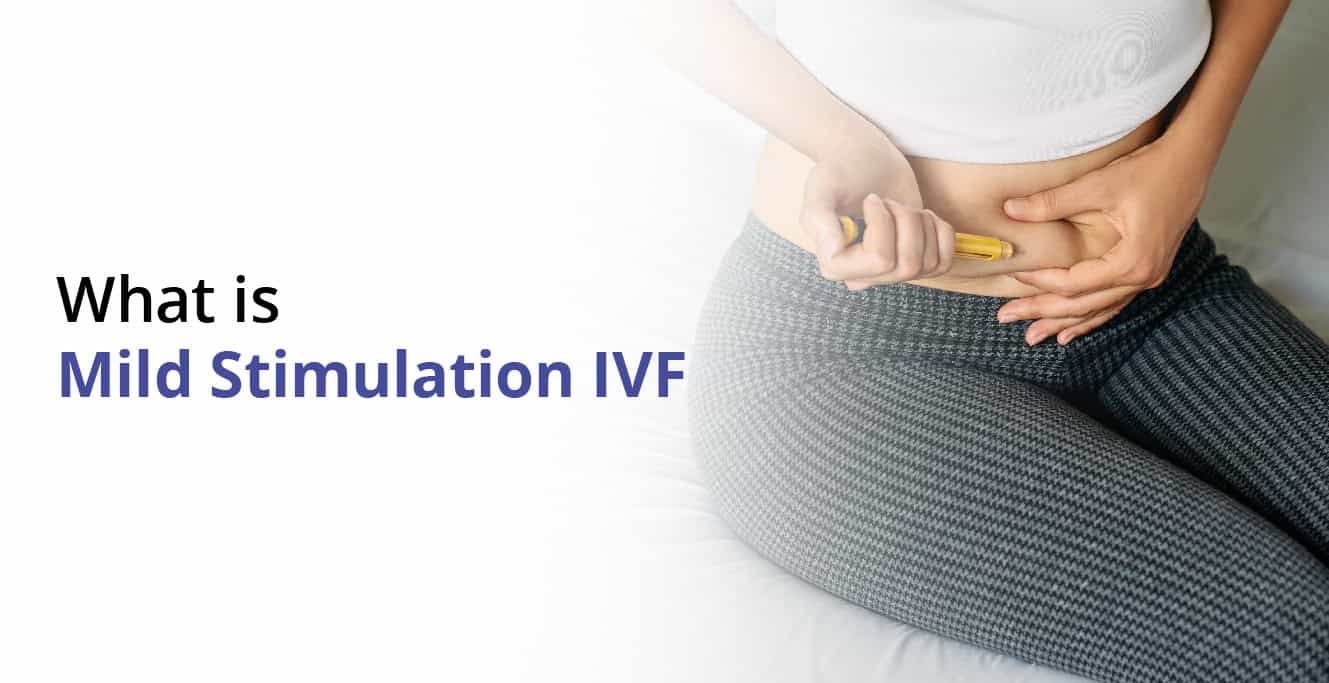 Mild Stimulation IVF ڇا آهي؟