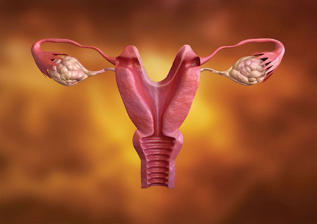 Bicornuate uterus Causes