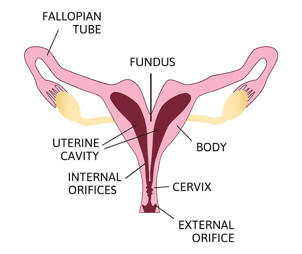 Causes of uterus didelphys