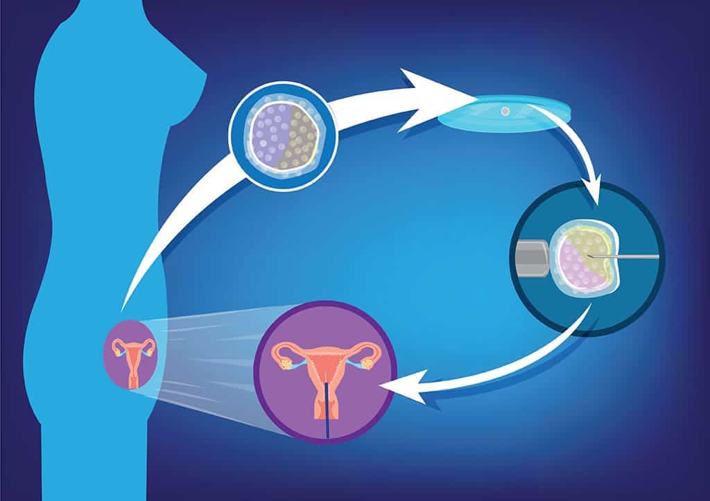 Embryo transfer