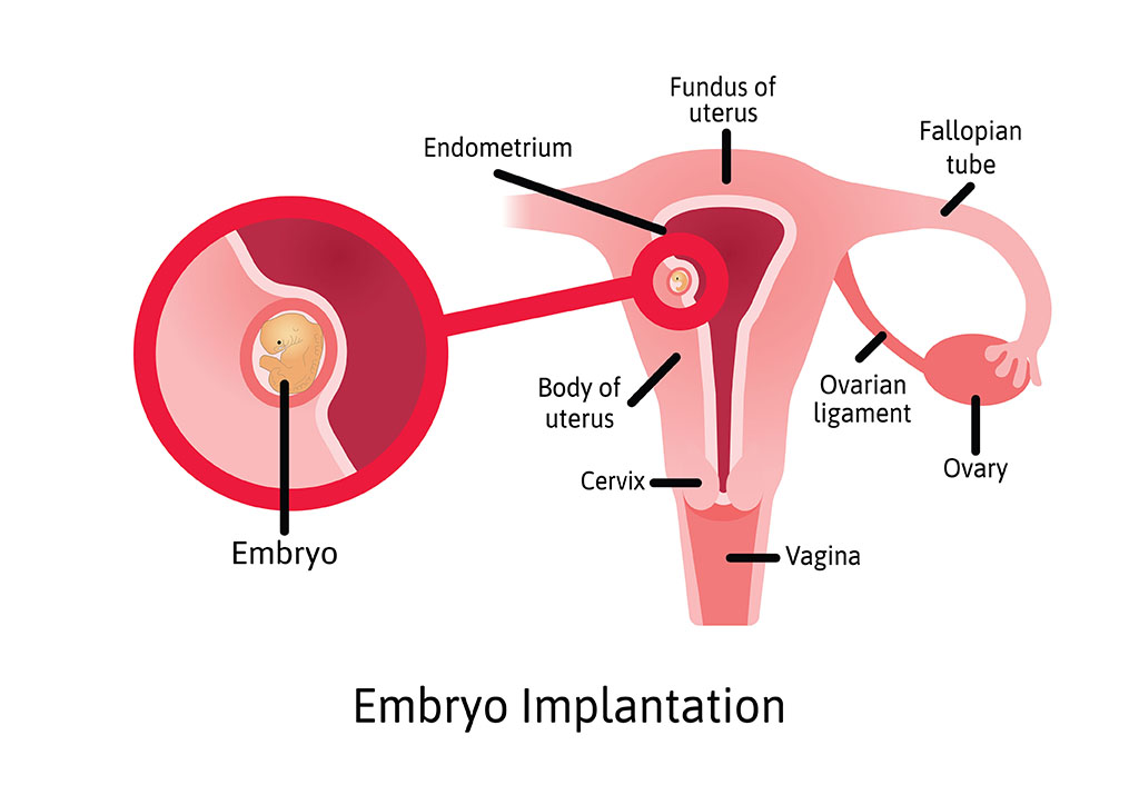 Endometrial Microbiome Metagenomic