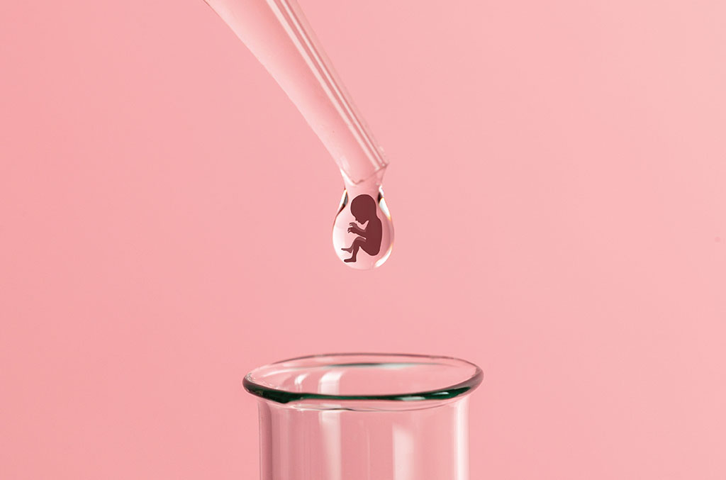 Endometrial Receptivity Analysis