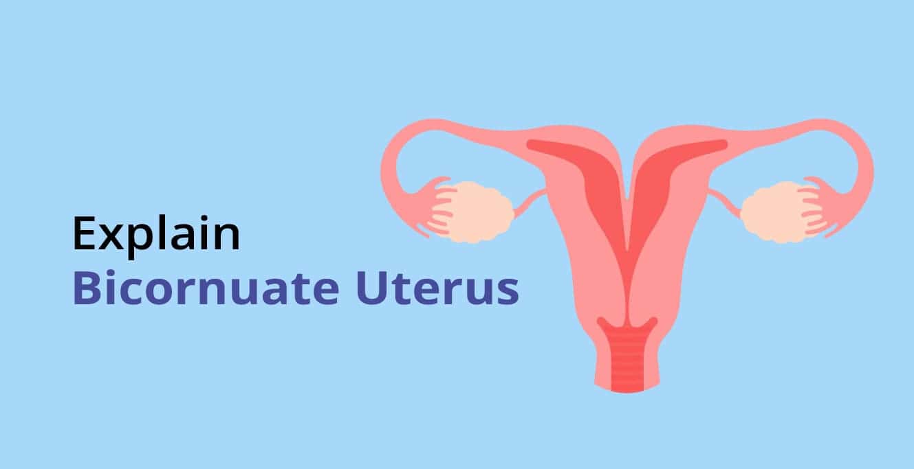 Bicornuate Uterus: ڇا توهان کي ڄاڻڻ گهرجي