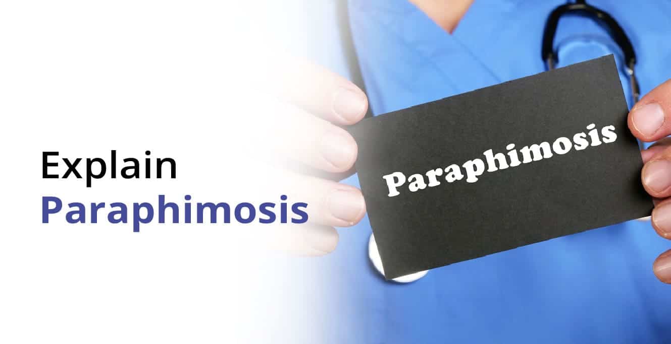 Paraphimosis: علامات، سبب، تشخيص، ۽ علاج