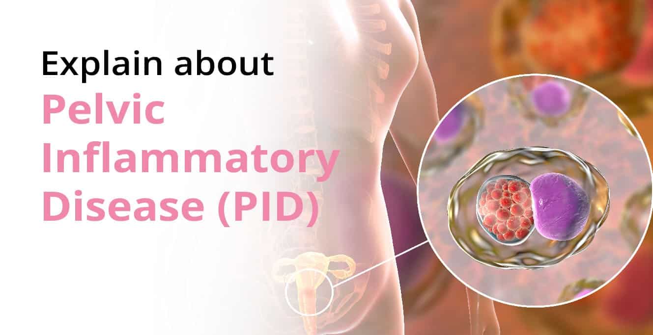 Pelvic inflammatory disease (PID) ڇا آهي؟