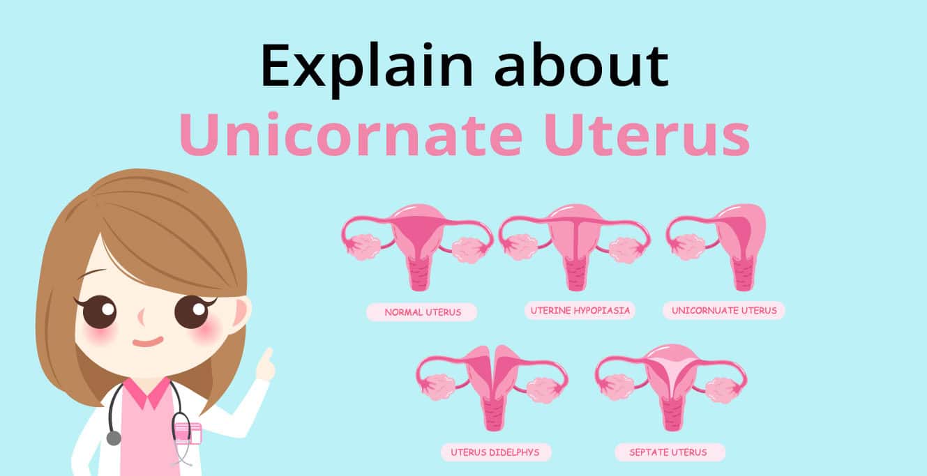 Unicornuate Uterus Treatment, Causes & its Type