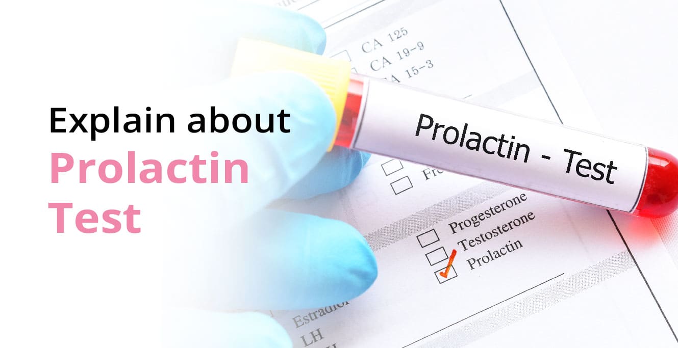 Prolactin Test: What is It and Why is It Done?