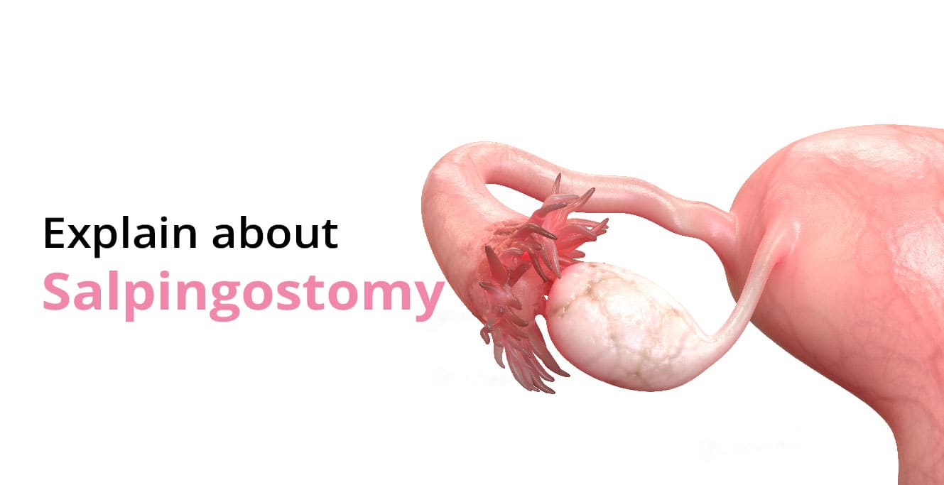 What is Salpingostomy?