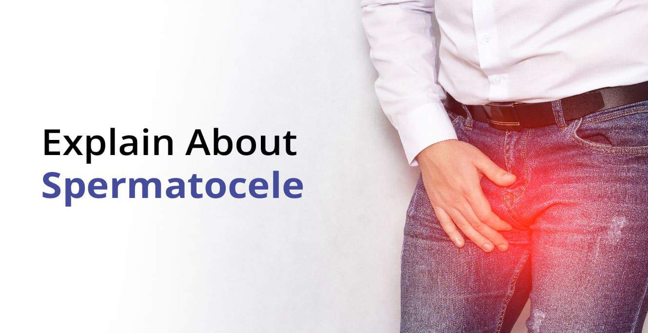 Spermatocele: علامات، سبب، ۽ علاج