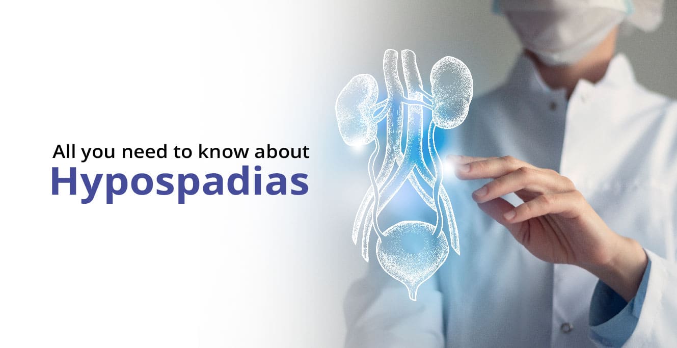 What is Hypospadias? – Causes & Symptoms
