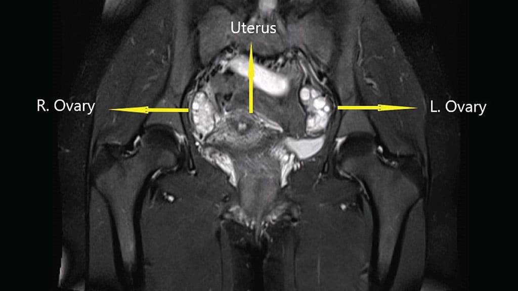 ਚੁੰਬਕੀ ਗੂੰਜ ਪ੍ਰਤੀਬਿੰਬ (MRI)