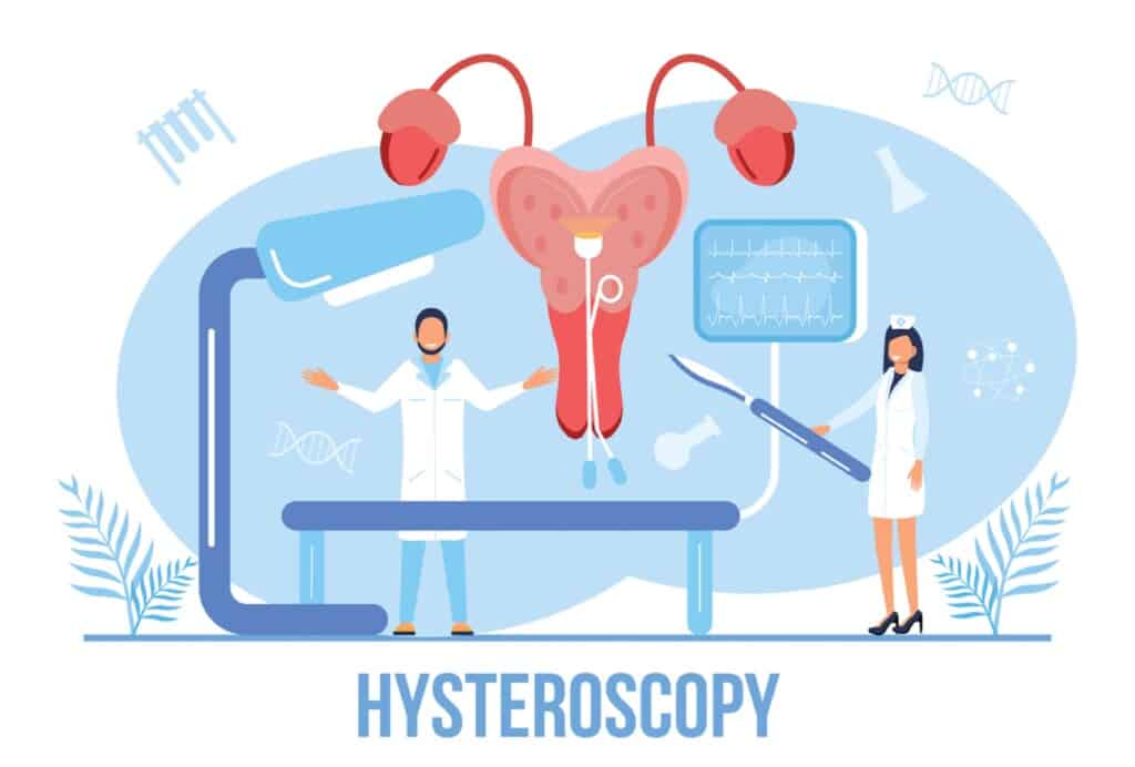 Surgery of arcuate uterus