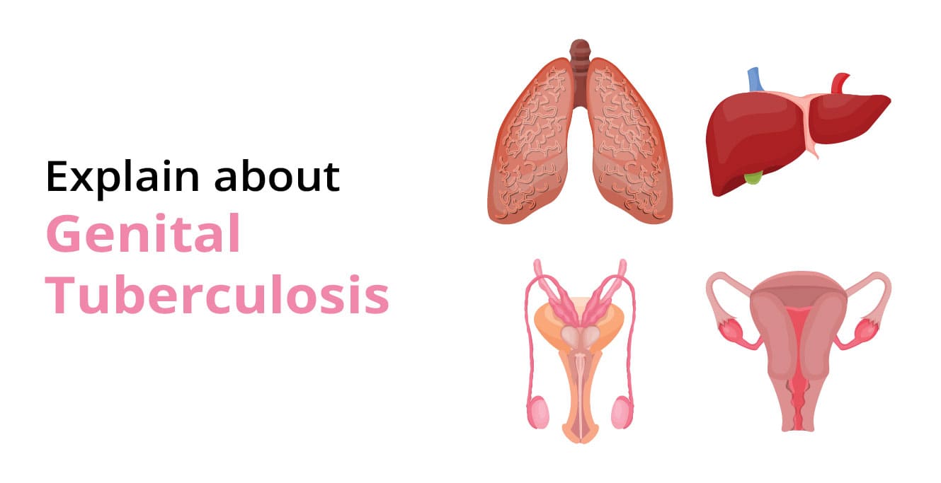 What is Genital Tuberculosis? | Causes & Symptoms