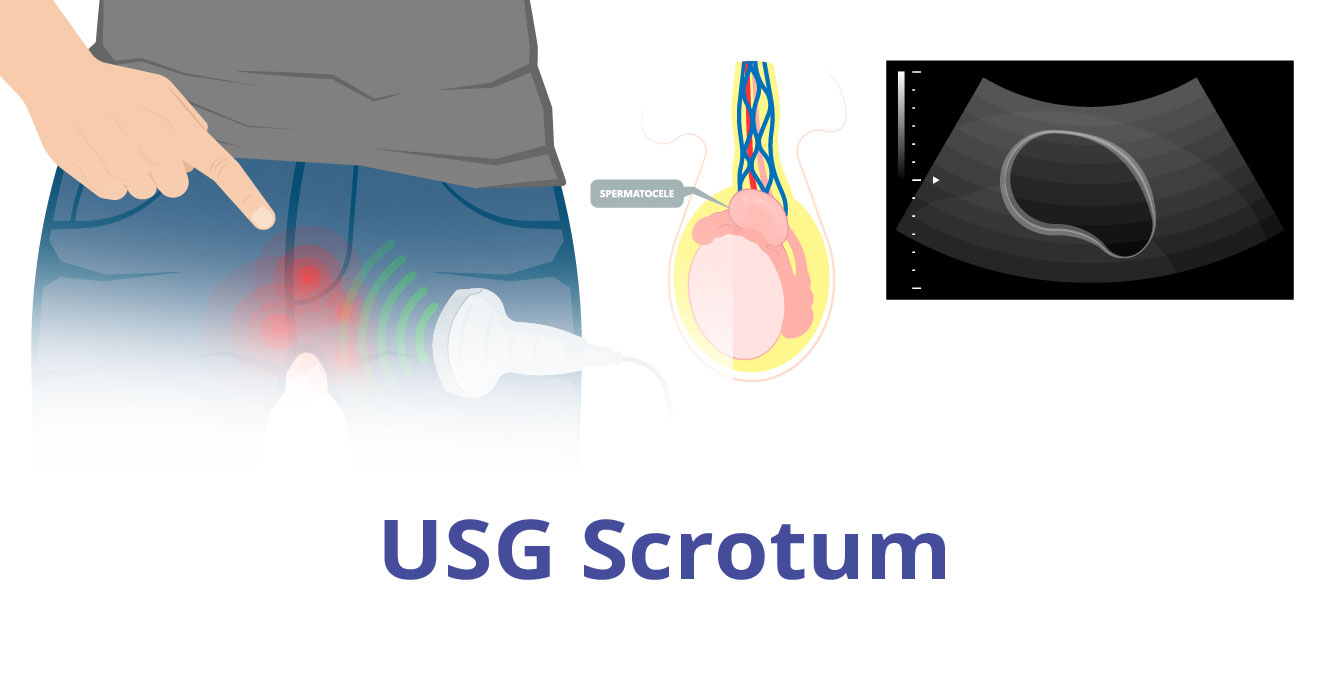 What is the USG Scrotum